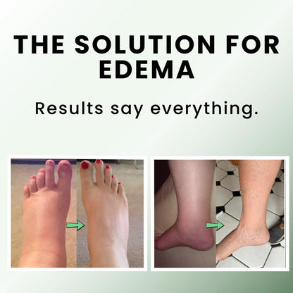 Curliqui™ Relief Balm